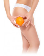 Narancsbőr ellen, cellulitis kezelés